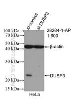 DUSP3 Antibody in Western Blot (WB)