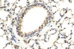 ADRB1 Antibody in Immunohistochemistry (Paraffin) (IHC (P))