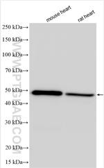 ADRB1 Antibody in Western Blot (WB)