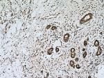 UBE2D1/2/3/4 Antibody in Immunohistochemistry (Paraffin) (IHC (P))