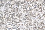 EEA1 Antibody in Immunohistochemistry (Paraffin) (IHC (P))