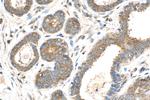 EEA1 Antibody in Immunohistochemistry (Paraffin) (IHC (P))