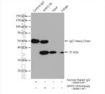 ARPC1B Antibody in Immunoprecipitation (IP)