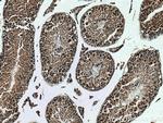 KIF2C Antibody in Immunohistochemistry (Paraffin) (IHC (P))