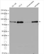 KIF2C Antibody in Western Blot (WB)