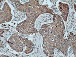 UPF1 Antibody in Immunohistochemistry (Paraffin) (IHC (P))