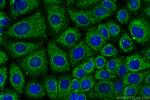 Beta TRCP Antibody in Immunocytochemistry (ICC/IF)