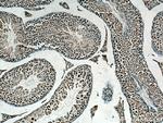 Beta TRCP Antibody in Immunohistochemistry (Paraffin) (IHC (P))