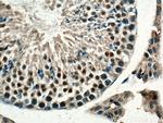 Beta TRCP Antibody in Immunohistochemistry (Paraffin) (IHC (P))