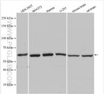 Beta TRCP Antibody in Western Blot (WB)