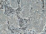 ATG7 Antibody in Immunohistochemistry (Paraffin) (IHC (P))