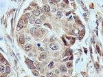 FBXW7 Antibody in Immunohistochemistry (Paraffin) (IHC (P))