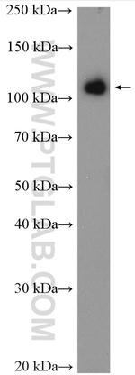 FBXW7 Antibody in Western Blot (WB)