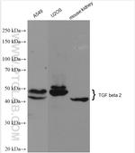 TGF beta 2 Antibody in Western Blot (WB)