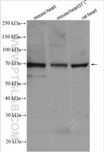 NCX1 Antibody in Western Blot (WB)