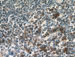 IL-15 Antibody in Immunohistochemistry (Paraffin) (IHC (P))