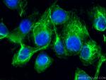 Cytokeratin 5 Antibody in Immunocytochemistry (ICC/IF)