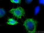 Cytokeratin 5 Antibody in Immunocytochemistry (ICC/IF)