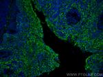 Cytokeratin 5 Antibody in Immunohistochemistry (PFA fixed) (IHC (PFA))
