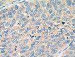 PIEZO1 (extracellular domain) Antibody in Immunohistochemistry (Paraffin) (IHC (P))