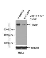 PIEZO1 (extracellular domain) Antibody in Western Blot (WB)