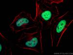 PRKDC Antibody in Immunocytochemistry (ICC/IF)