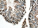 PRKDC Antibody in Immunohistochemistry (Paraffin) (IHC (P))