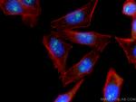 LEF1 Antibody in Immunocytochemistry (ICC/IF)