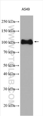 Integrin Beta 5 Antibody in Western Blot (WB)