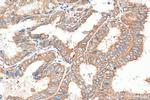 ABCE1 Antibody in Immunohistochemistry (Paraffin) (IHC (P))