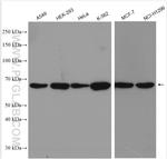 ABCE1 Antibody in Western Blot (WB)