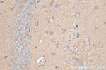 PICALM Antibody in Immunohistochemistry (Paraffin) (IHC (P))