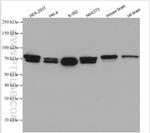 PICALM Antibody in Western Blot (WB)