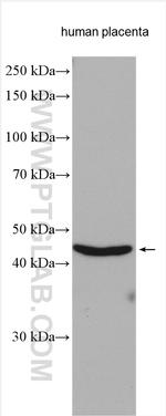 PTPLAD1 Antibody in Western Blot (WB)