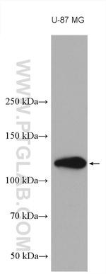 NOTCH2 Antibody in Western Blot (WB)