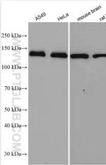 SUPT16H Antibody in Western Blot (WB)