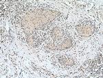 Cyclin B1 Antibody in Immunohistochemistry (Paraffin) (IHC (P))