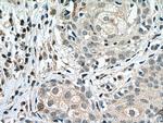 Cyclin B1 Antibody in Immunohistochemistry (Paraffin) (IHC (P))