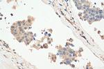 PPP1CA Antibody in Immunohistochemistry (Paraffin) (IHC (P))