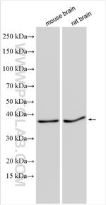 CCSAP Antibody in Western Blot (WB)