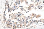 ATF4 Antibody in Immunohistochemistry (Paraffin) (IHC (P))