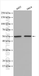 ATF4 Antibody in Western Blot (WB)