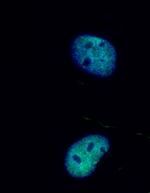 RFC5 Antibody in Immunocytochemistry (ICC/IF)