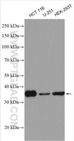 RFC5 Antibody in Western Blot (WB)