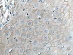 Claudin 1 Antibody in Immunohistochemistry (Paraffin) (IHC (P))