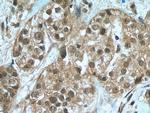 HORMAD1 Antibody in Immunohistochemistry (Paraffin) (IHC (P))