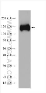 KCC2/SLC12A5 Antibody in Western Blot (WB)