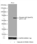 Phospho-AKT (Ser473) Antibody in Western Blot (WB)