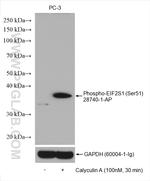 Phospho-EIF2S1 (Ser51) Antibody in Western Blot (WB)