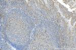 TNFR2 Antibody in Immunohistochemistry (Paraffin) (IHC (P))